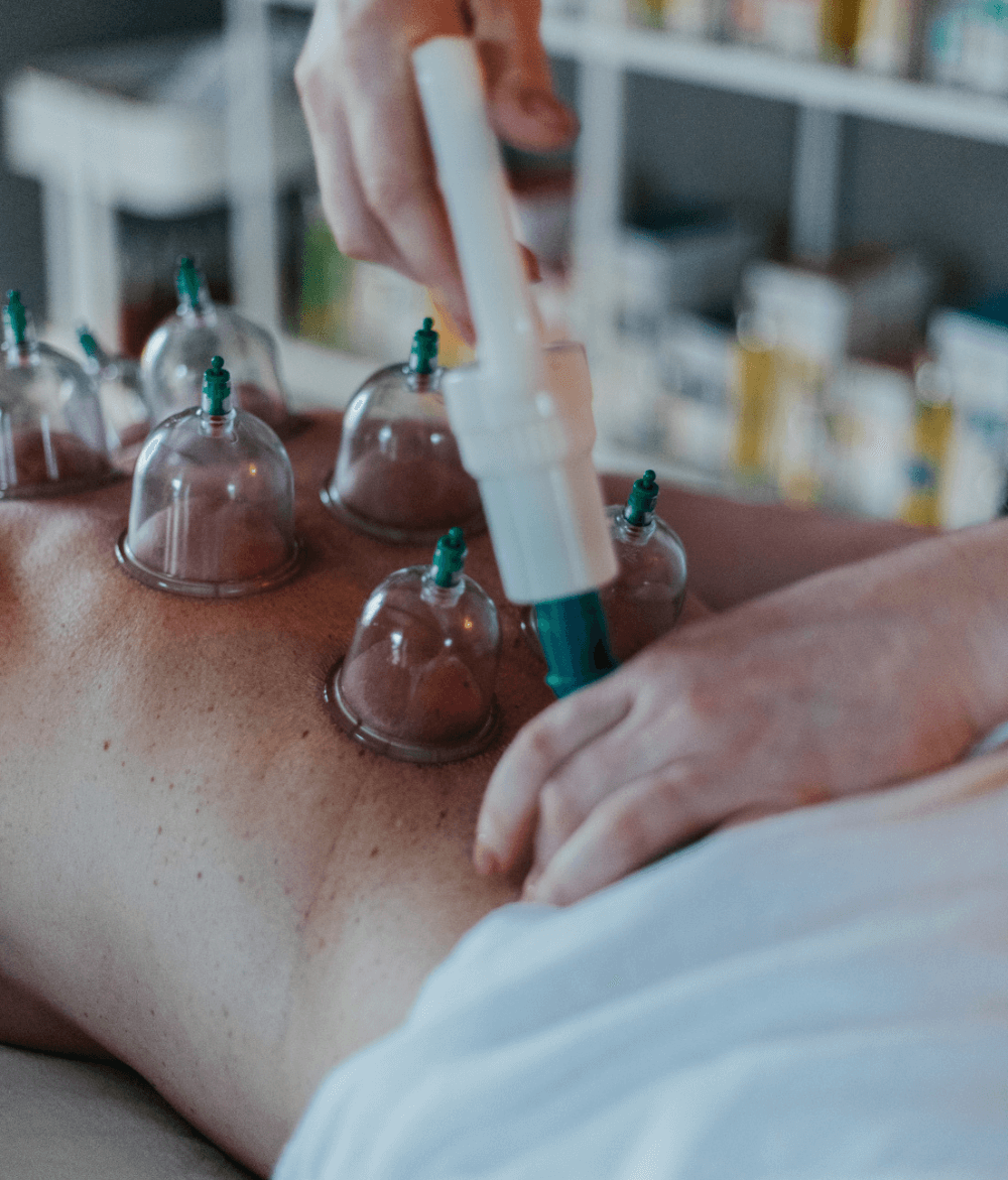 Stress og bindevæv - Cupping - Mette Buhl